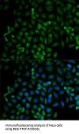 F-Box/WD Repeat-Containing Protein 1A (BTRC) Antibody