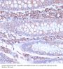 Cyclic ADP Ribose Hydrolase (CD38) Antibody