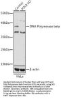 Polymerase DNA Directed Beta (POLB) Antibody