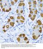 Polymerase DNA Directed Beta (POLB) Antibody