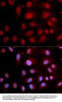 Polymerase DNA Directed Beta (POLB) Antibody