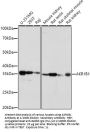 Aldose Reductase (AKR1B1) Antibody