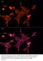 Aldose Reductase (AKR1B1) Antibody