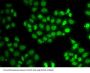 Ewing Sarcoma Breakpoint Region 1 (EWSR1) Antibody