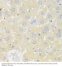 Cytochrome P450 11A1 (CYP11A1) Antibody