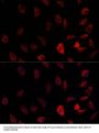 Cytochrome P450 11A1 (CYP11A1) Antibody