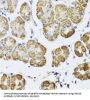 Histone Deacetylase 6 (HDAC6) Antibody