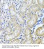 Histone Deacetylase 6 (HDAC6) Antibody