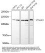Vinculin (VCL) Antibody