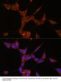 Aldo-Keto Reductase Family 1 Member C3 (AKR1C3) Antibody