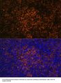 Inducible T-Cell Costimulator (ICOS) Antibody