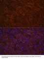 Inducible T-Cell Costimulator (ICOS) Antibody