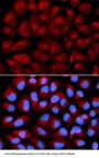 Fanconi Anemia Complementation Group C (FANCC) Antibody