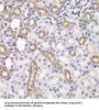 Kelch Like ECH Associated Protein 1 (KEAP1) Antibody