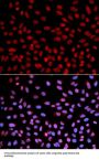 DNA Polymerase Eta (POLH) Antibody