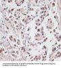 H/ACA Ribonucleoprotein Complex Subunit DKC1 (DKC1) Antibody