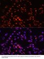H/ACA Ribonucleoprotein Complex Subunit DKC1 (DKC1) Antibody