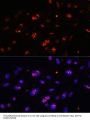 H/ACA Ribonucleoprotein Complex Subunit DKC1 (DKC1) Antibody