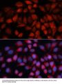 Acyl-CoA Dehydrogenase, C-4 To C-12 Straight Chain (ACADM) Antibody