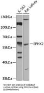 Epoxide Hydrolase 2, Cytoplasmic (EPHX2) Antibody