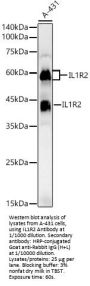 Interleukin 1 Receptor Type II (IL1R2) Antibody