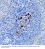Peptidyl Arginine Deiminase Type IV (PADI4) Antibody