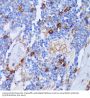 Peptidyl Arginine Deiminase Type IV (PADI4) Antibody