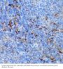 Peptidyl Arginine Deiminase Type IV (PADI4) Antibody