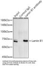 Lamin B1 (LMNB1) Antibody