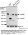 Lamin B1 (LMNB1) Antibody