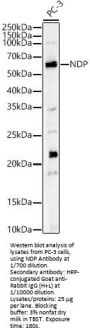 Norrin (NDP) Antibody