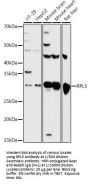 Ribosomal Protein L5 (RPL5) Antibody