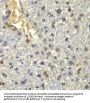 Ribosomal Protein L5 (RPL5) Antibody