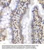 26S Proteasome Regulatory Subunit 6A (PSMC3) Antibody