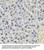 26S Proteasome Regulatory Subunit 6A (PSMC3) Antibody