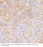 Serum Amyloid P-Component (APCS) Antibody