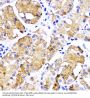 Bone Morphogenetic Protein Receptor 1B (BMPR1B) Antibody