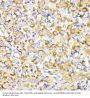 Bone Morphogenetic Protein Receptor 1B (BMPR1B) Antibody