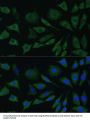Bone Morphogenetic Protein Receptor 1B (BMPR1B) Antibody