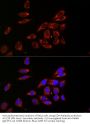 Cytidine Deaminase (CDA) Antibody