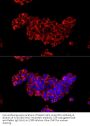 Cytidine Deaminase (CDA) Antibody