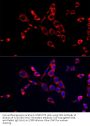 Cytidine Deaminase (CDA) Antibody