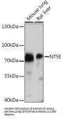 5'-Nucleotidase / CD73 (NT5E) Antibody