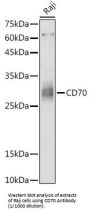 CD70 Antigen / TNFSF7 (CD70) Antibody