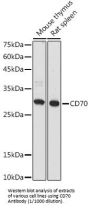 CD70 Antigen / TNFSF7 (CD70) Antibody