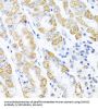 Cyclin Dependent Kinase 4 Inhibitor C (CDKN2C) Antibody
