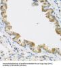 Cyclin Dependent Kinase 4 Inhibitor C (CDKN2C) Antibody