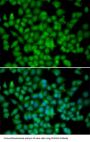Cyclin Dependent Kinase 4 Inhibitor C (CDKN2C) Antibody