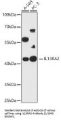 Interleukin 13 Receptor Alpha 2 (IL13RA2) Antibody