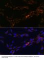 Interleukin 13 Receptor Alpha 2 (IL13RA2) Antibody